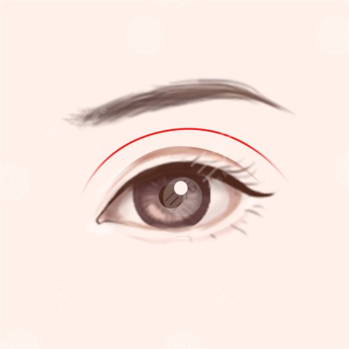 黄胜华医生眼部手术术后