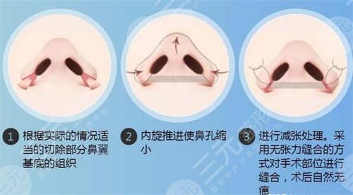 怀化天姿整形2019全新价格表详览及隆鼻整形案例分享