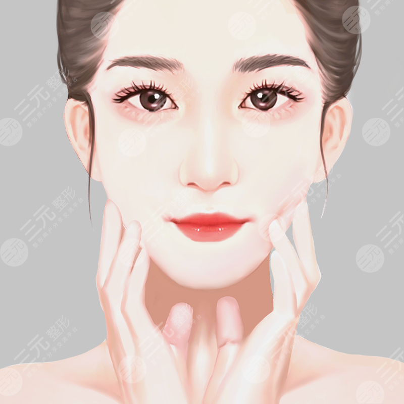 双下巴吸脂案例
