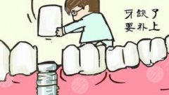 种植牙有什么风险和后遗症？危害大吗？科普解答，消除担忧！