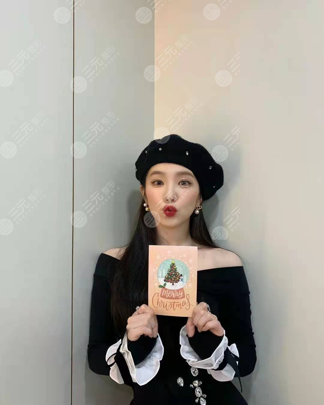 Irene裴珠泫状态良好，颜值回春?