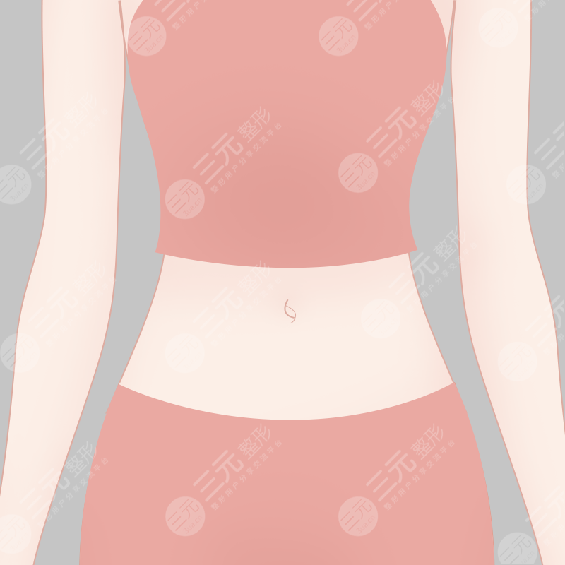 宁波市第六医院整形科吸脂案例术前