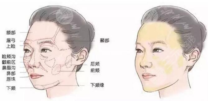 昆医附二院整形科刘垠