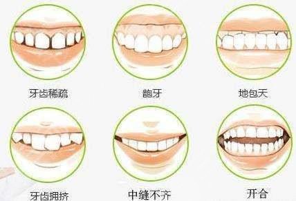 上海伊尔意口腔医院牙齿矫正案例