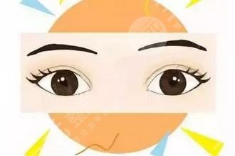 深圳于国东做双眼皮整形术后2个月