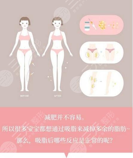 美联臣抽脂多少钱？全新价格表公布，附腰腹吸脂案例分享~