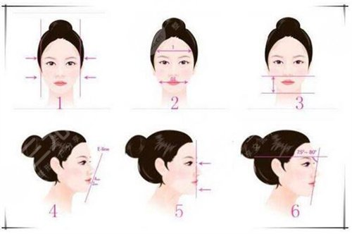 成都美极整形价格贵不贵?附垫下巴案例反馈