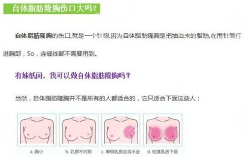 成都智悦全新价格表曝光附自体填充案例反馈