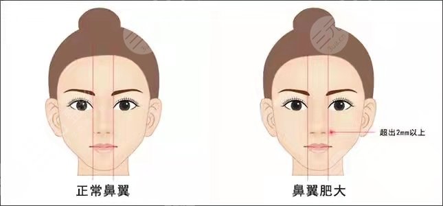 收藏！北京协和朱琳双眼皮案例，4月价格表更新了~