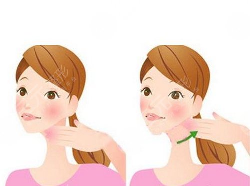  北京佰华利医美面部吸脂案例