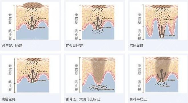 上海九院隆鼻专家排名,漂亮的隆鼻案例来袭