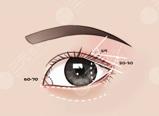 眼部综合手术案例