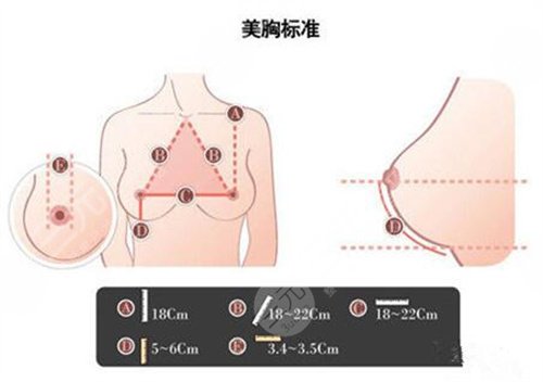 自体脂肪隆胸