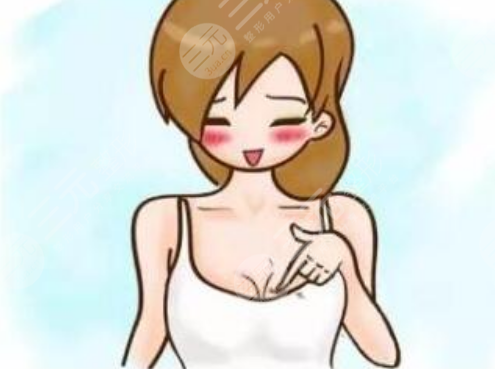 假体隆胸