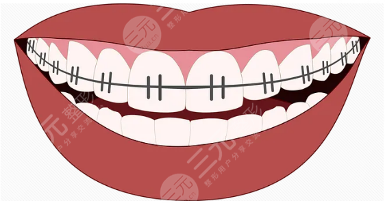 九院牙齿美白牙齿案例