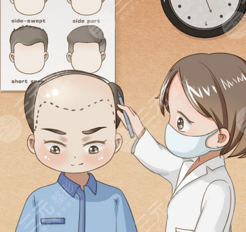 发际线种植：从传统到科技的新篇章