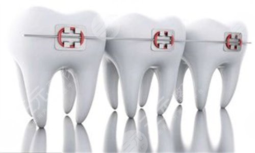 长沙口腔医院牙齿矫正案例前