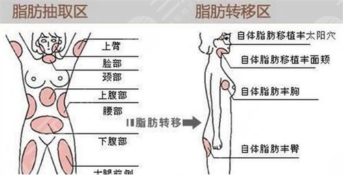 面部年轻化案例前