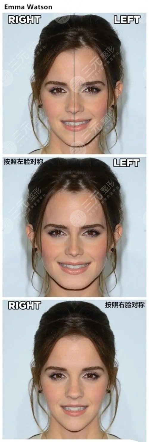 据说没有谁的脸是左右对称的怎么判断自己的脸歪不歪