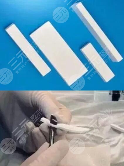 假体隆鼻