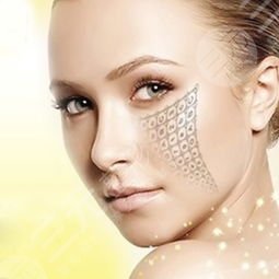 上海九院做热玛吉案例图