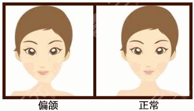 2021南宁医科大口腔牙齿矫正案例