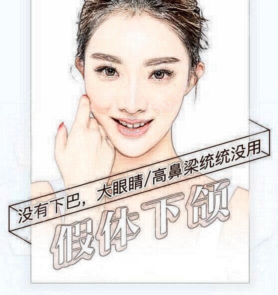 西京整形医院假体垫下巴真实案例分享
