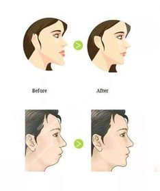 上海瑞泰口腔医院种植牙案例分享