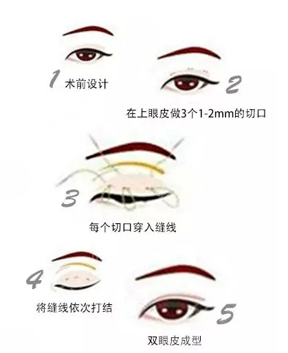 潍坊市中医院整形美容科