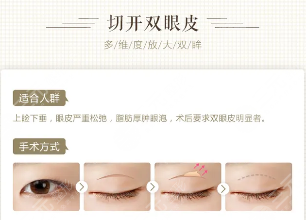 北部战区总医院整形外科好吗?附:崭新价格表|双眼皮案例