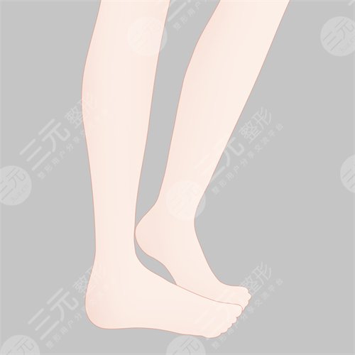 吸脂减肥整形手术经过