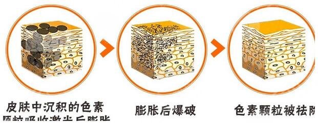 青医附院美容整形科点痣价目表，案例图