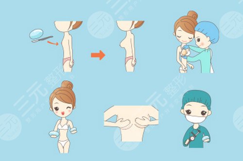 湘雅二医院整形科崭新价目表新鲜出炉啦!附:隆胸案例图+注意事项