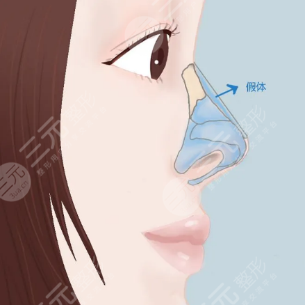 广州韩佳人整形医院怎么样？价格表2021抢先一览