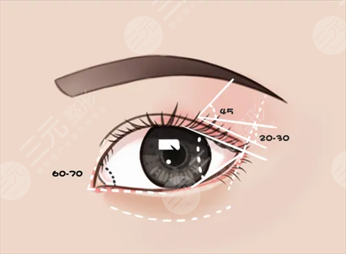 西京医院整形科眼部修复案例