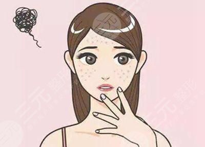 点阵激光后恢复过程图，焕发新生肌的光彩，这果我爱了！
