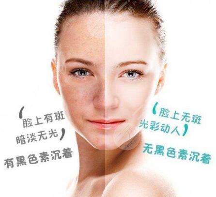 保定除皱