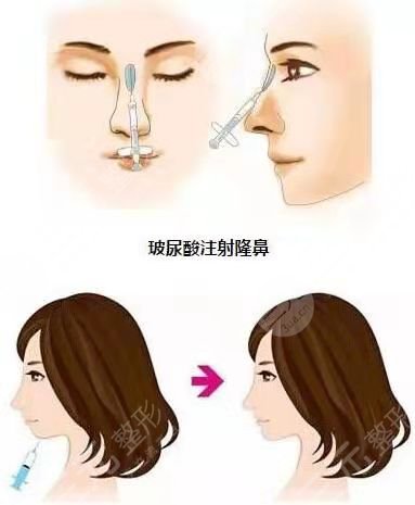 漳州市医院整容价格表