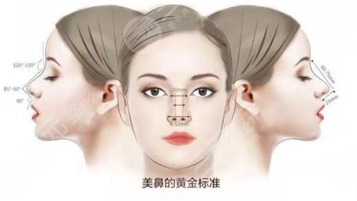 广州曙光整形医院程鹏隆鼻案例后