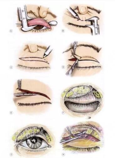 长得不好看的我