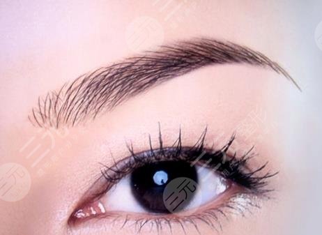 种植眉毛
