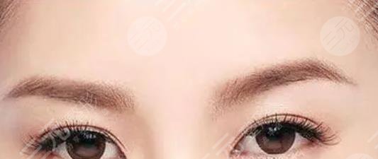 眉毛种植