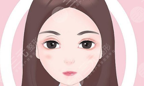 于晓波双眼皮修复价格贵不贵于医生技术好吗双眼皮失败那些事