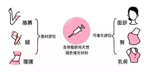 二次冷冻脂肪填充技术原理