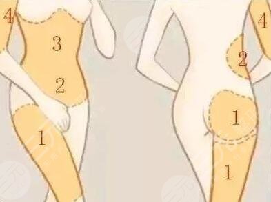 自体脂肪填充面颊多久可以侧睡?