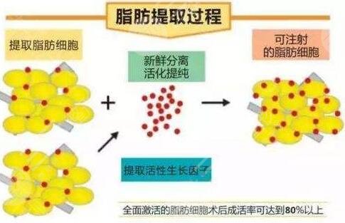 自体脂肪填充额头的弊端