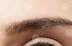 眉毛种植后能维持几年，价格多少钱？美眉宝典2022全新分享！