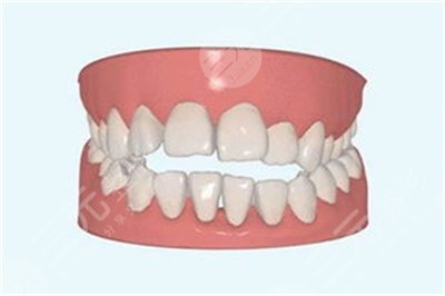 上海九院正畸价格表