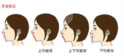上海九院正畸价格表