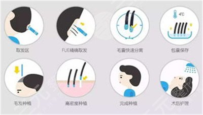 湘潭中心医院植发价格表